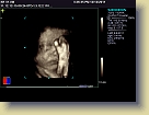 Week32-Siemens-Ultrasound-Dec2011 (3) * 1024 x 768 * (118KB)